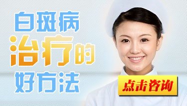 女性散发型白癜风怎么办