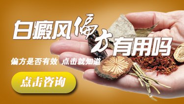 白癜风用偏方能治好吗