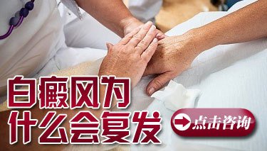 白癜风反复发作是什么情况