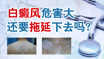 脸部白癜风能参加高考吗能上大学吗