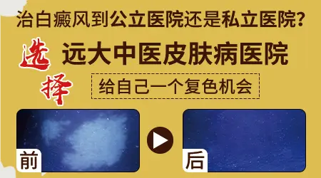 屁股沟起白癜风怎么回事