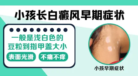 小孩腿上出现小白点图