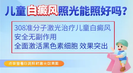 儿童得白癜风的原因是什么