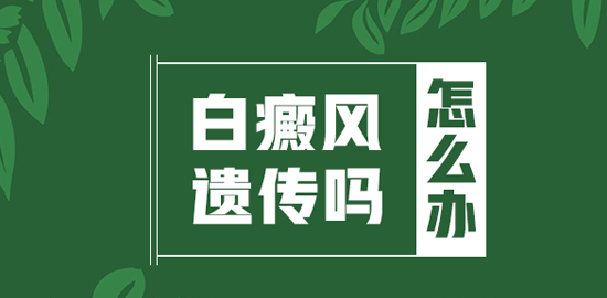 白癜风隔代遗传的几率大概是多少