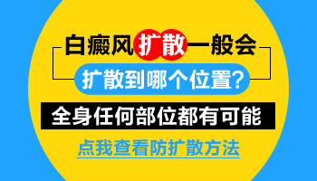 儿童隐藏部位白癜风会不会长出来