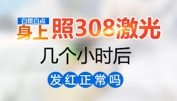 308激光照射白斑以后发红正不正常