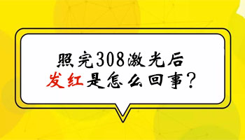 臀部白癜风照了激光发红有点疼怎么办