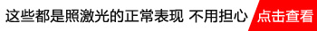 白癜风照308激光一次就基本变黑了是为什么