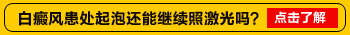 邯郸白癜风照308起了泡泡能不能弄破