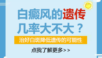 爸爸有白癜风遗传给孩子的几率大吗