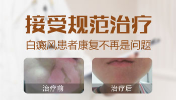 补充白癜风患者体内黑色素的食物都有哪些