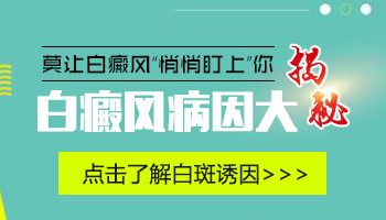 手背上突然出现几个白癜风是怎么回事