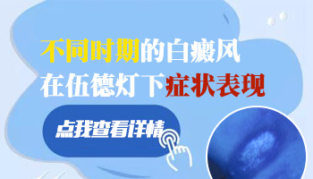 身上长白斑做伍德灯检测对身体有没有危害