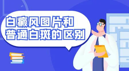 白癜风和白斑有何不同