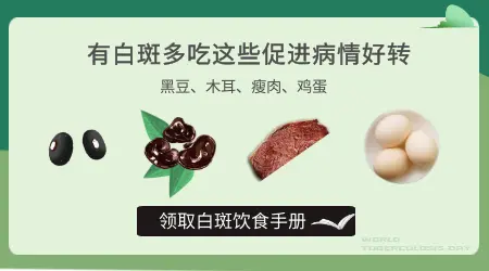 白癜风吃什么食物效果好