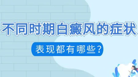 全身散在型白斑多年了怎么治