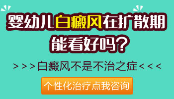 幼儿进展期白癜风能打308激光吗