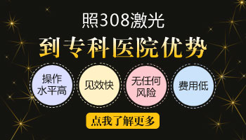 小孩面部白癜风照308激光多少钱一个光斑