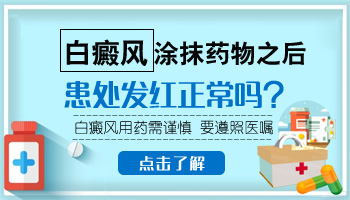 治疗儿童白癜风的药膏有哪些