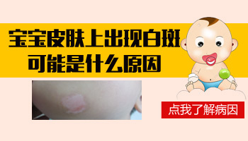 宝宝出生腿上有块白