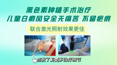 小孩白癜风种植黑色素好不好