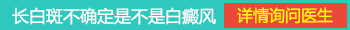 面部有一点白不太明显是白癜风吗