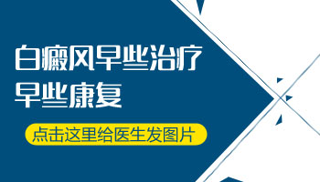 伍德灯检查白斑还是很科学的，不同的白斑病在伍德灯下的颜色不一样，而且不一样的白斑皮损程度在伍德灯下荧光强弱也是多有差别的。  　　如果患者的白斑在伍德灯下是蓝白色，表明患者的白癜风病情不是很严重，可能是早期的白癜风。建议患者做进一步的检查——三维皮肤CT。