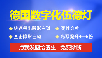 伍德灯显示蓝白色是不是白癜风