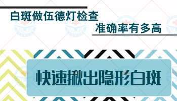 伍德灯确诊白斑是不是白癜风的准确率是多少