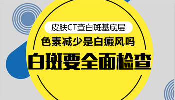 wood灯检查白癜风一次费用大概是多少