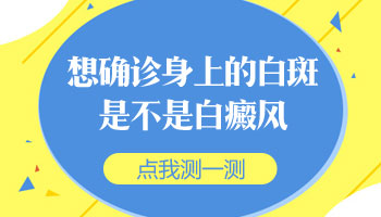 腿上有白点疑似是白癜风怎么确诊病症