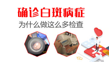 儿童白斑做伍德灯还是Ct准确