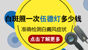 白癜风照伍德灯照一次多少钱