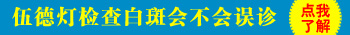 伍德氏灯能检查怎么确定是白癜风