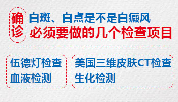 手上有些白点不知道是不是白癜风