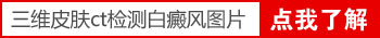 如何用玻璃检测白斑是不是白癜风