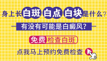 伍德氏灯检查白斑显示淡白色是什么意思