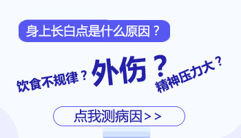 身上突然出现几个白点是什么 做哪些检查能确诊