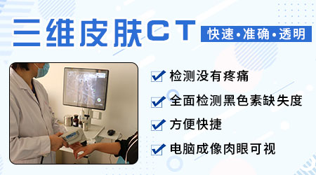 三维皮肤ct检测白斑一次多少钱