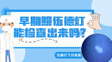 伍德氏灯照射白斑边界不清晰