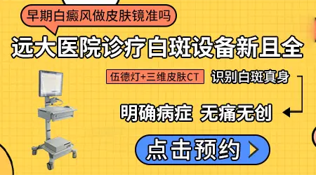 皮肤镜下白癜风是什么颜色