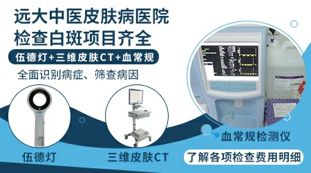 判断白癜风的简单方法