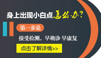 大腿根白斑图片 白斑怎么治能治好