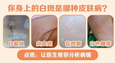 大腿根和屁股上的白斑是什么