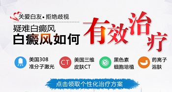 白癜风有2年了没扩散该怎么治