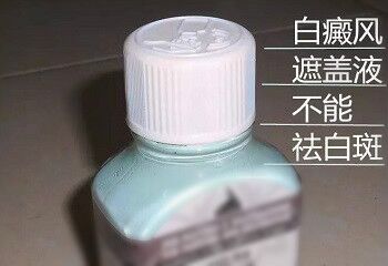 遮盖液治疗白癜风能管多长时间