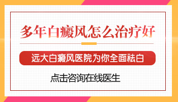 白癜风有好几年了怎么治