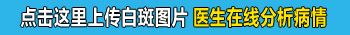 308准分子激光治疗白癜风效果如何