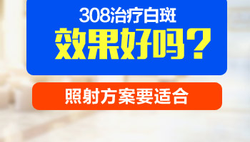 照多长时间白癜风就能看到效果了