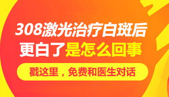 腿部长白癜风一般怎么治疗比较好些